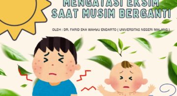 Eksim atau dermatitis atopik adalah kondisi kulit kronis yang memerlukan perhatian ekstra, terutama saat musim berganti. Foto: UM